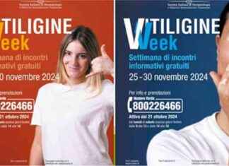 Incontri gratuiti con dermatologi durante la ‘Vitiligine Week’ nel Lazio news-14112024-224858